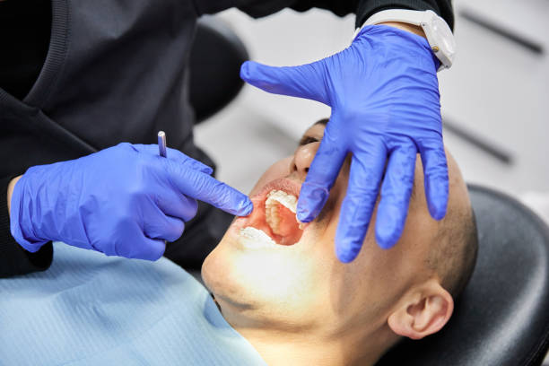 Best Broken or Chipped Tooth Repair in Blue Bell, PA